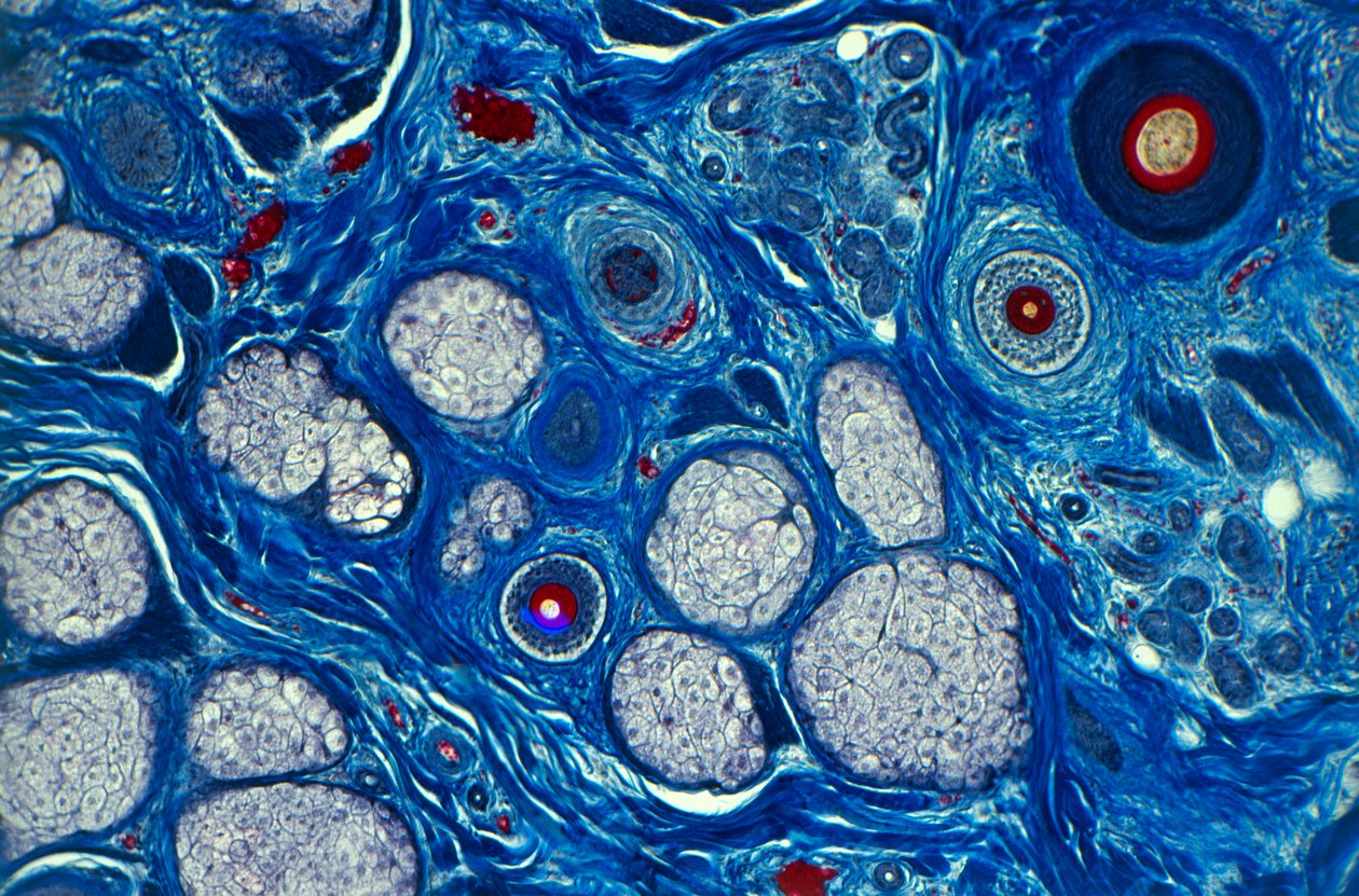 Pelle umana vista al microscopio, che mostra il fusto del capello e i pori sudoripari da Unknown