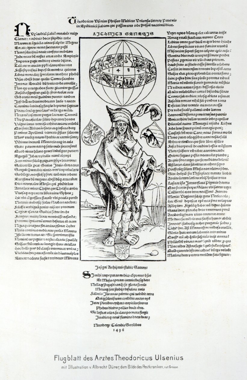 Illustrazione della sifilide, 1496 da Albrecht Dürer