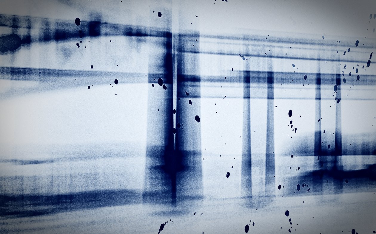 Neve (raggi X), 2019 da Alex Caminker