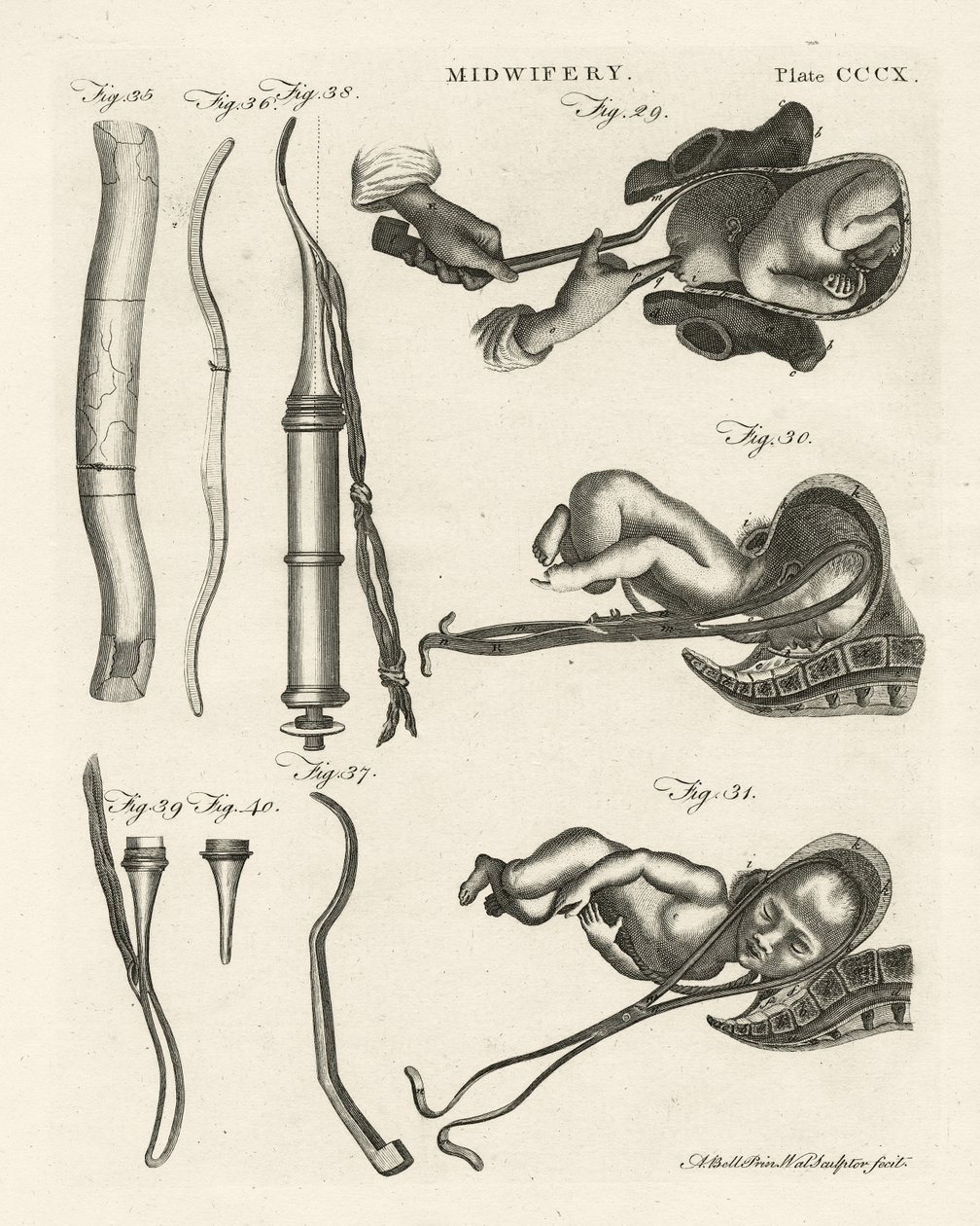 Ostetricia, illustrazione da 
