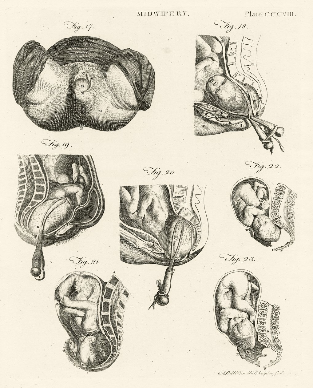 Ostetricia, illustrazione da 