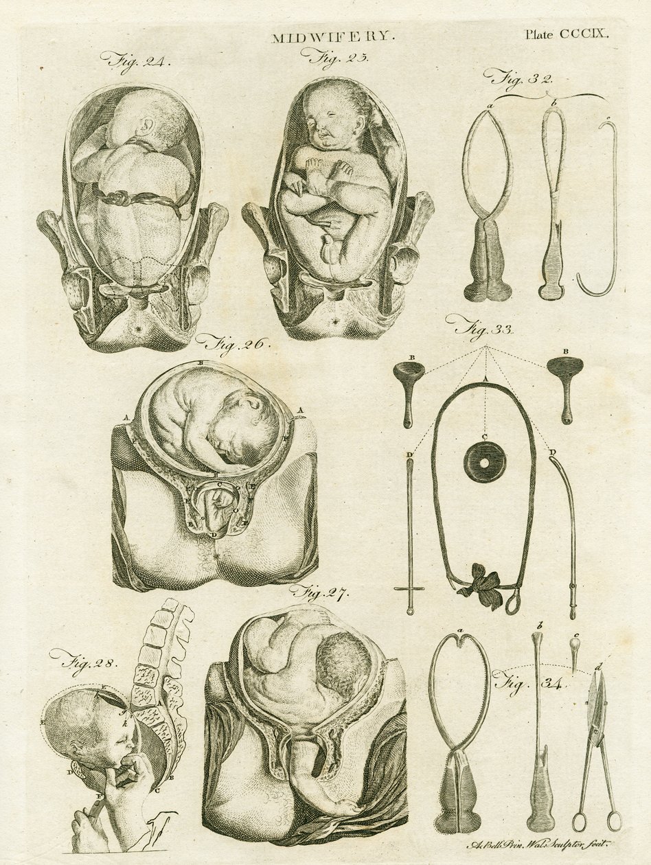 Ostetricia, illustrazione da 