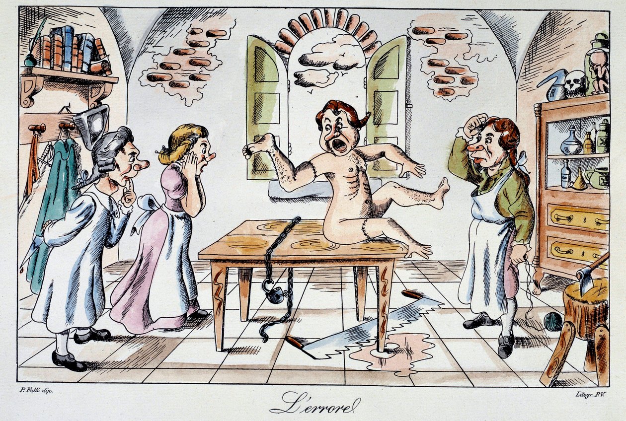 Errore chirurgico: un adesivo satirico che rappresenta i rischi corsi dai pazienti consegnati nelle mani di cattivi medici, un esempio di trapianto di braccio al posto della gamba. Incisione del XIX secolo da Anonymous Anonymous
