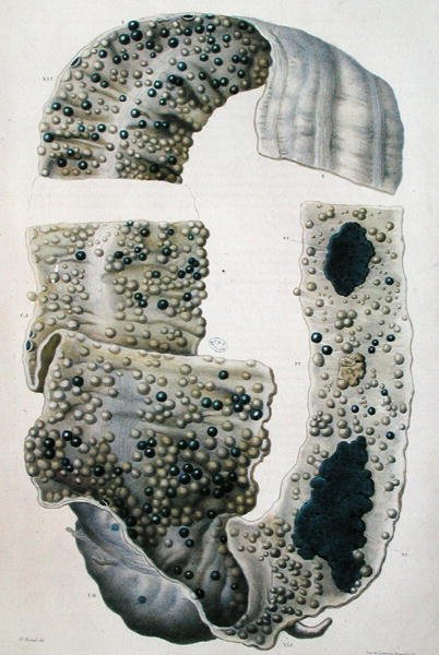 Malattie dell