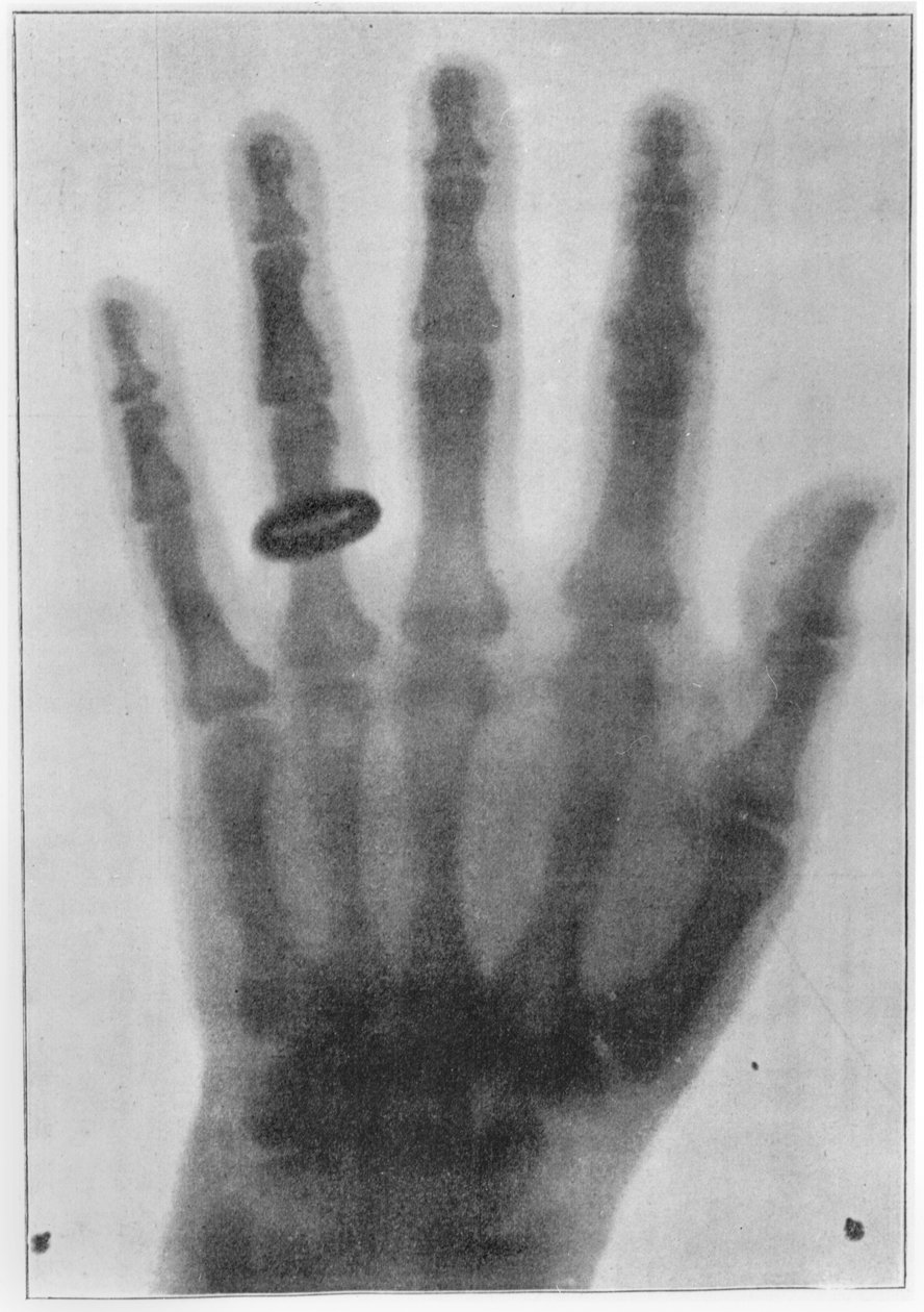 Radiografia della mano sinistra di Anna Bertha Ludwig, moglie di Röntgen da Carl August Voller
