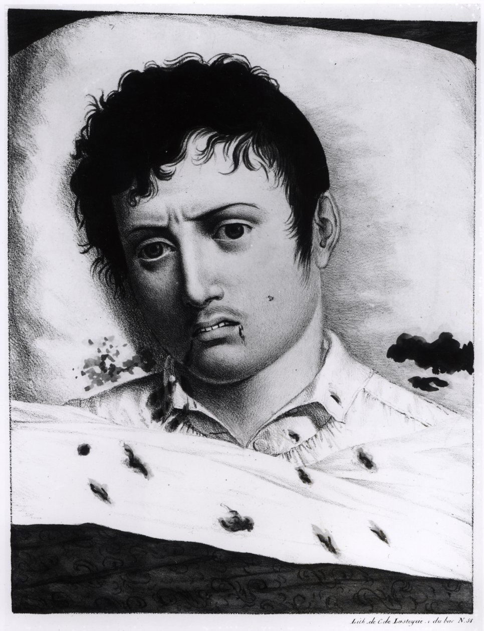 Osservazione della febbre gialla, c.1819 da Charles Lasteyrie du Saillant