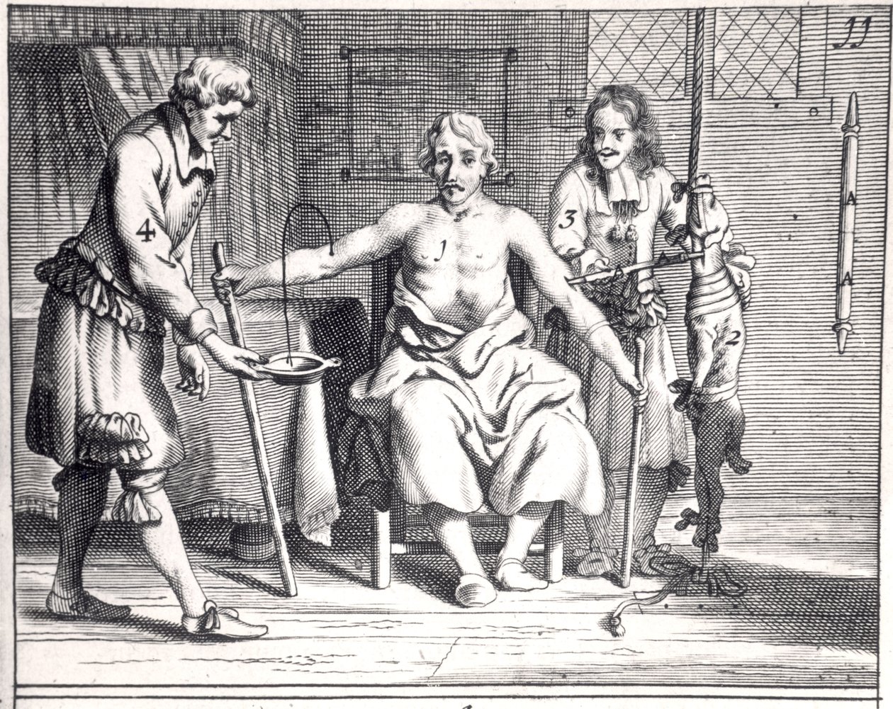 Trasfusione di sangue da un cane, da Armamentarii Chirurgici di Johannes Schultes pubblicato ad Amsterdam, 1671 da Dutch School