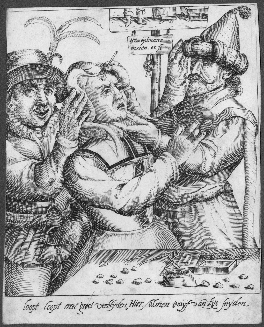 Trapanazione, inciso da H. Weydmans (XVI secolo) da Dutch School