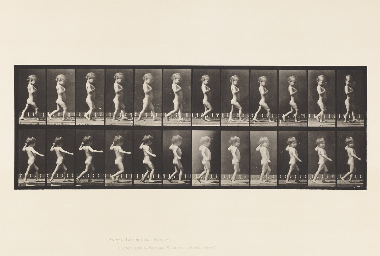 A, Gambe arcuate; Ragazzo; B, Carie spinale; Ragazza che cammina da Eadweard Muybridge
