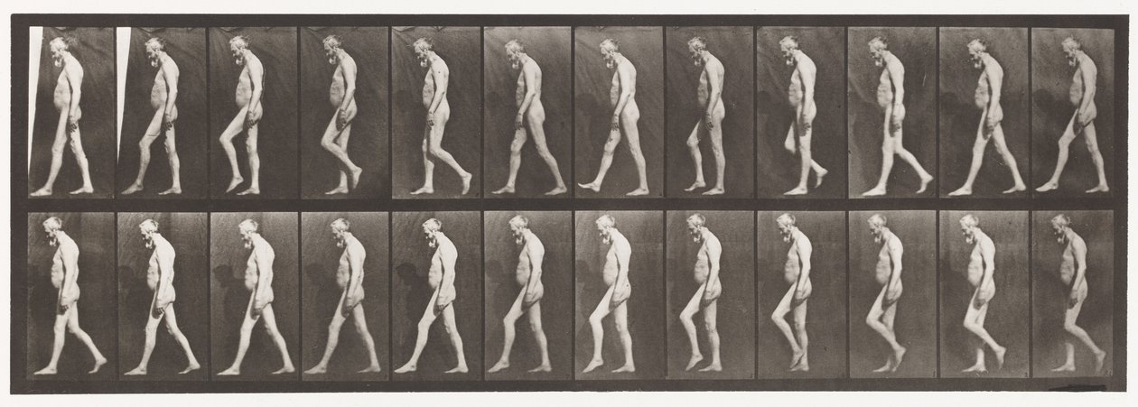 Tavola 555. Atrofia muscolare delle gambe; adulto, A,B, camminare, 1885 da Eadweard Muybridge