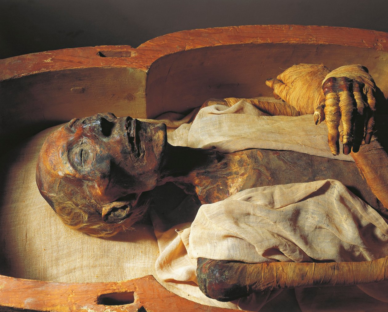 Mummia di Ramses II (circa 1297-1213 a.C.), dettaglio da Egyptian 19th Dynasty