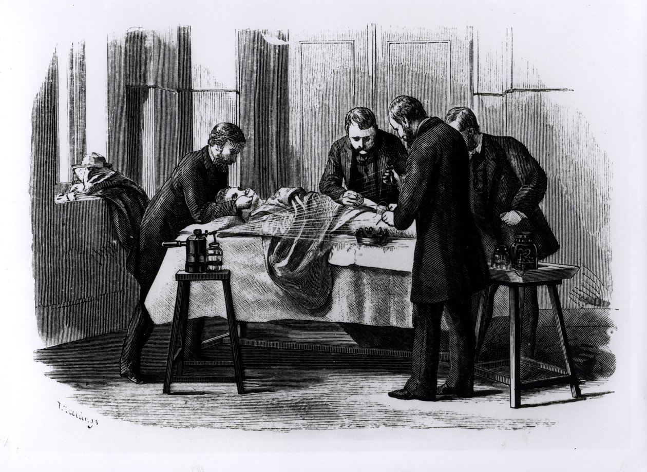 Chirurgia Antisettica, 1882 da English School