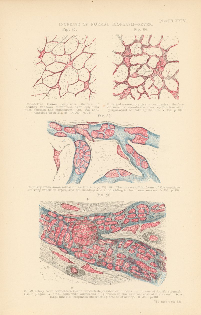Aumento del bioplasma normale, febbre (litografia a colori) da English School