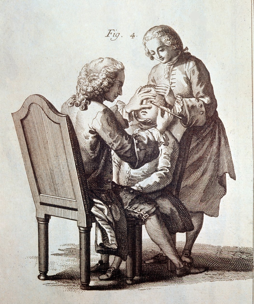 Un dottore che opera un paziente con cataratta, illustrazione dall