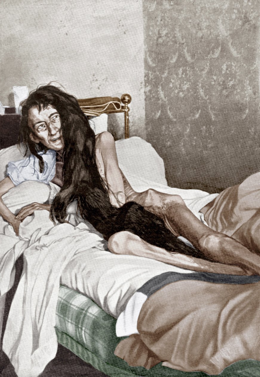 Blanche Monnier in ospedale, Poitiers, giugno 1901 (stampa) da French School