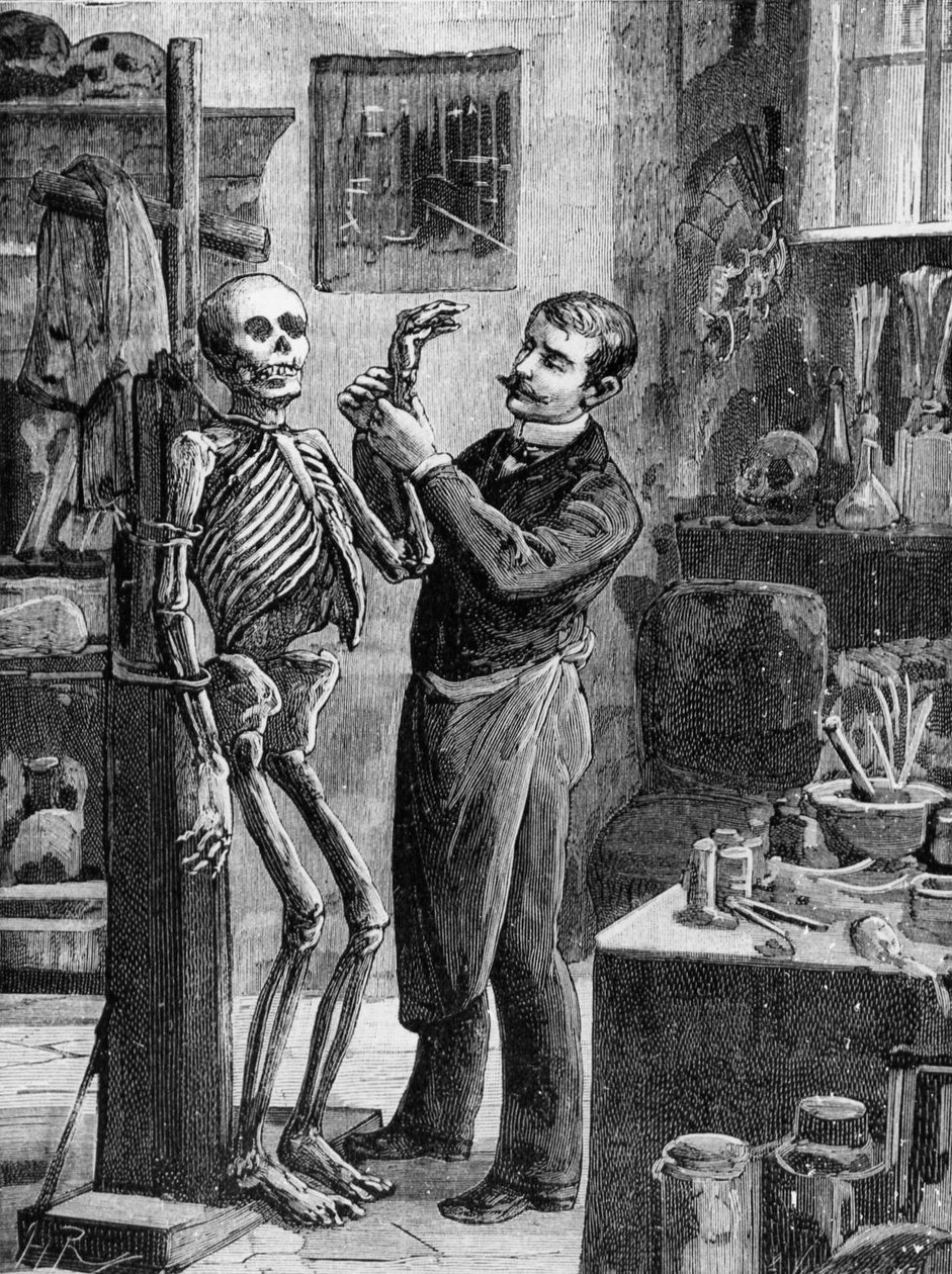 Caso Gouffé: La ricostruzione immaginaria del cadavere Gouffé dal dottor Lacassagne - in "La Malle Sanglante", ed. A. Fayard, Parigi, n.d. - Parigi, B.H.V.P.D. da French School