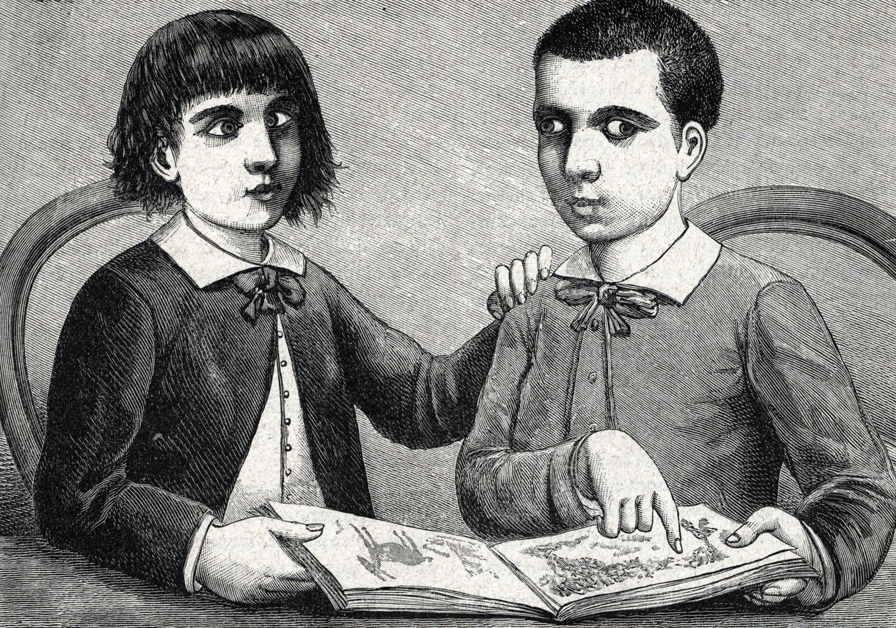 Bambini con strabismo convergente e divergente o occhi incrociati (incisione) 1888 da French School