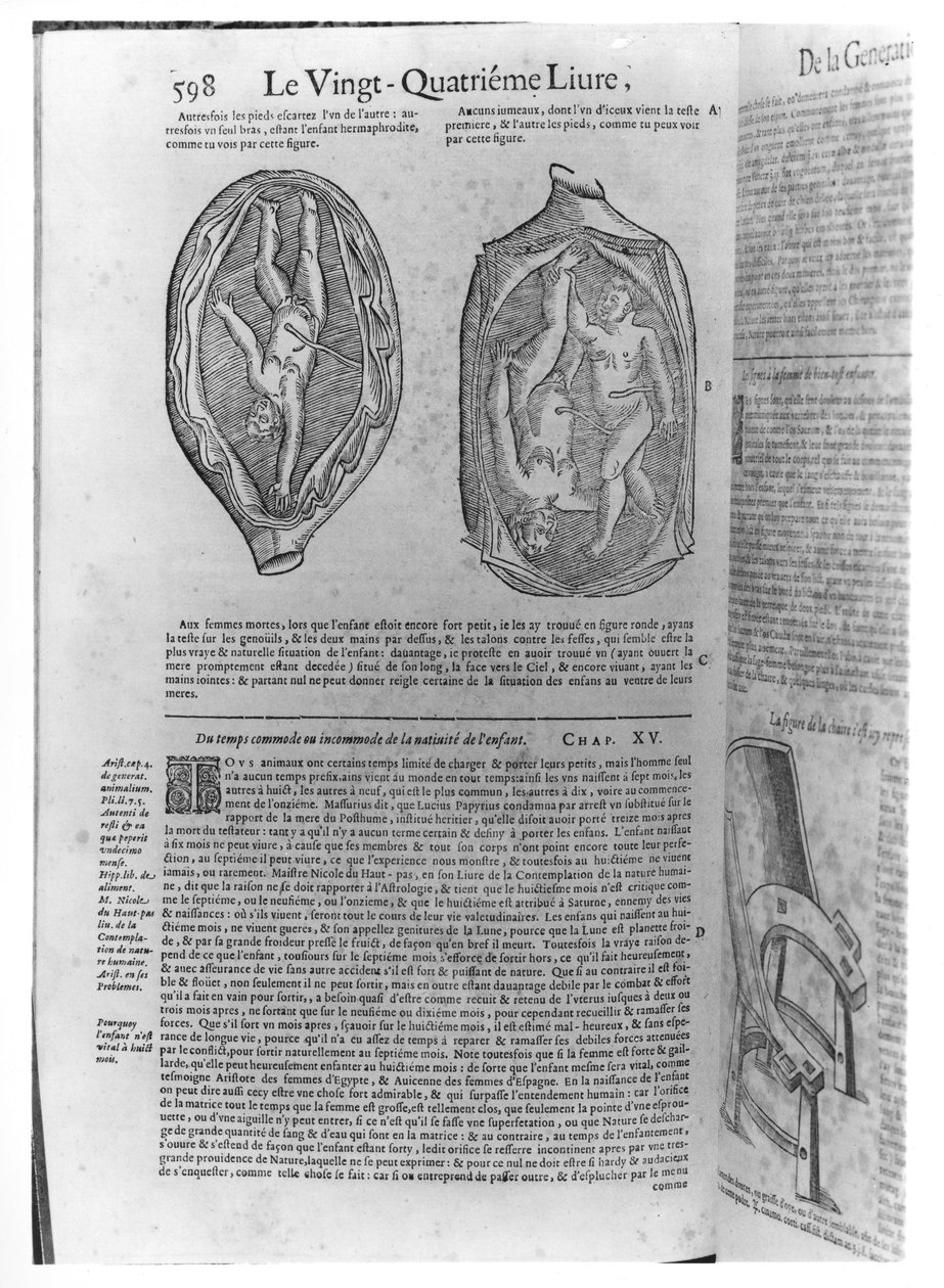 Feto, illustrazione da Oeuvres di Ambroise Pare (1509-90) pubblicato a Lione, 1641 da French School