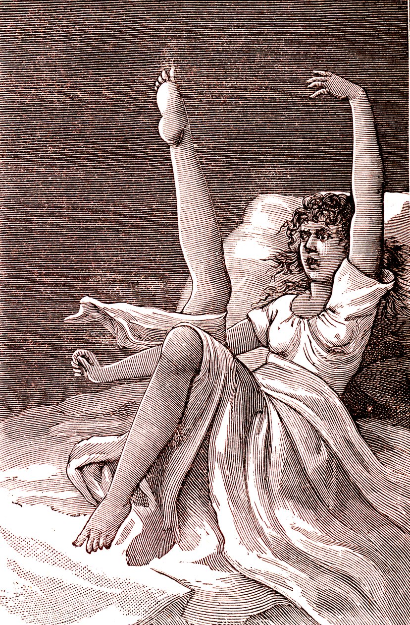 Isteria, un fenomeno mentale estremo, psicosi e psiconeurosi. 1887 da French School