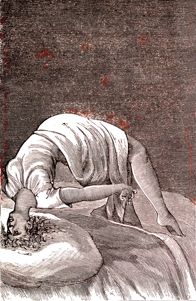 Isteria, disturbo mentale e nervoso, derivante da intensa ansia. 1887 da French School