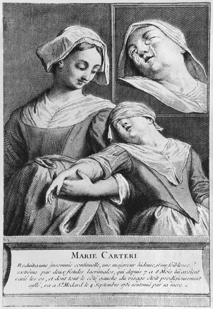 Guarigione miracolosa di una donna cieca, Marie Carteri, sulla tomba del diacono Francois de Paris al cimitero parrocchiale di Saint-Medard a Parigi da French School