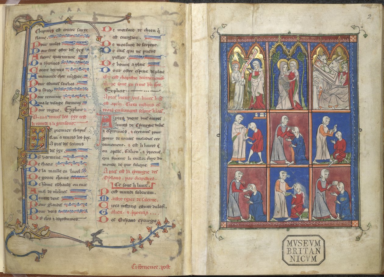Sloane 1977,f.2 La Chirurgia: Scene bibliche e mediche da French School