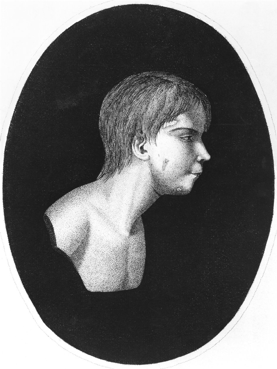 Vittorio di Aveyron, frontespizio di De l