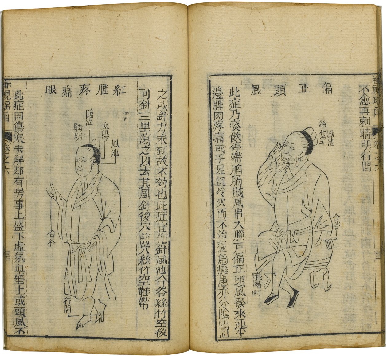 Shen Shi Yao Han Un prezioso libro di oftalmologia da Fu Renyu