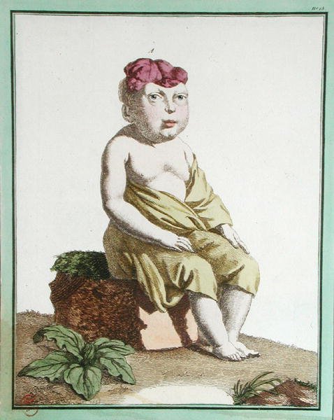 Bambino con metà testa, da 
