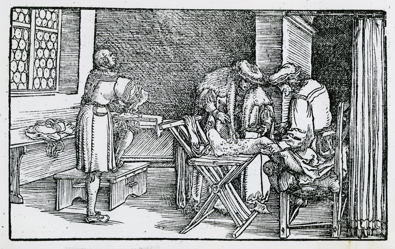 Il trattamento di una gamba gangrenosa da German School