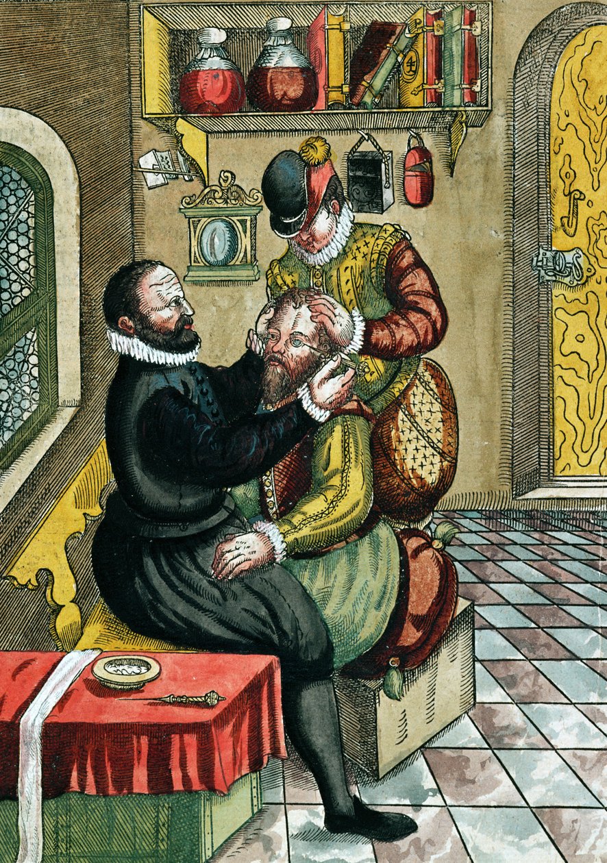 Operazione di cataratta, da Ophthalmodouleia di Georg Bartisch (1535-1636) pubblicato a Dresda nel 1583 da German School