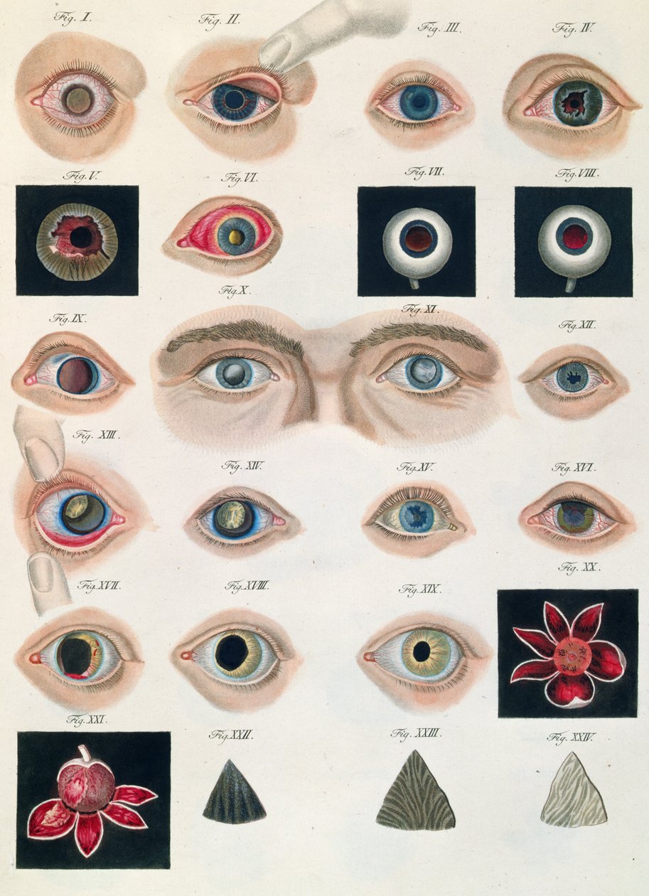 Descrizione delle anomalie congenite dell