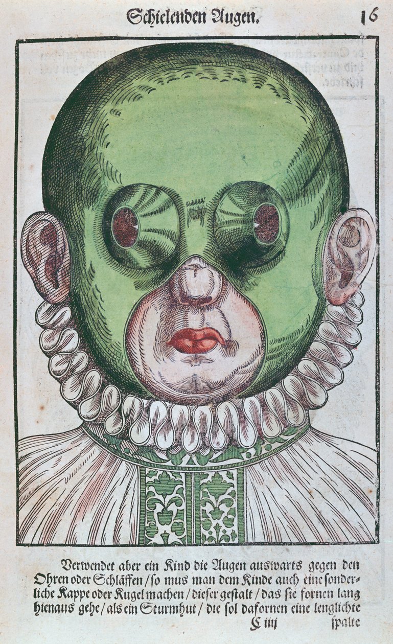 Maschera per il trattamento di uno strabismo, da Ophthalmodouleia di Georg Bartisch (1535-1636) pubblicato a Dresda nel 1583 da German School