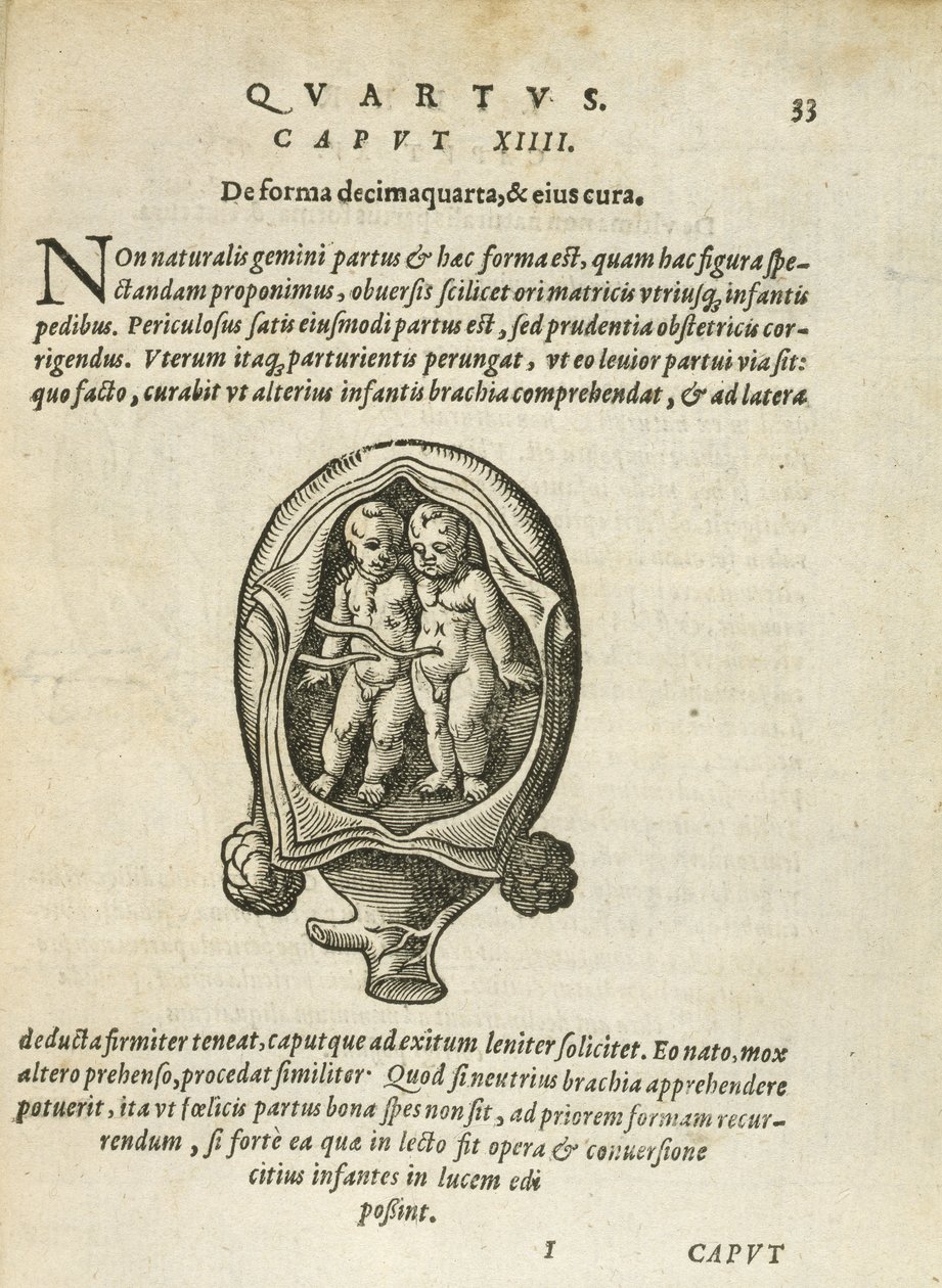 Gemelli non identici nel grembo materno, illustrazione dal capitolo 14, Libro 4 di Sulla concezione e crescita dell