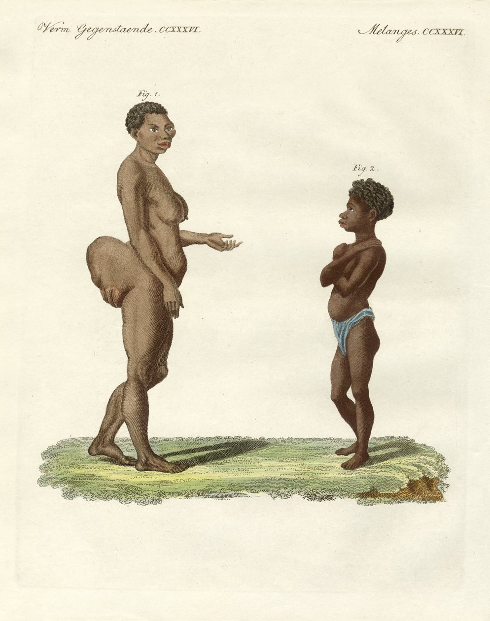Strane varietà umane da German School