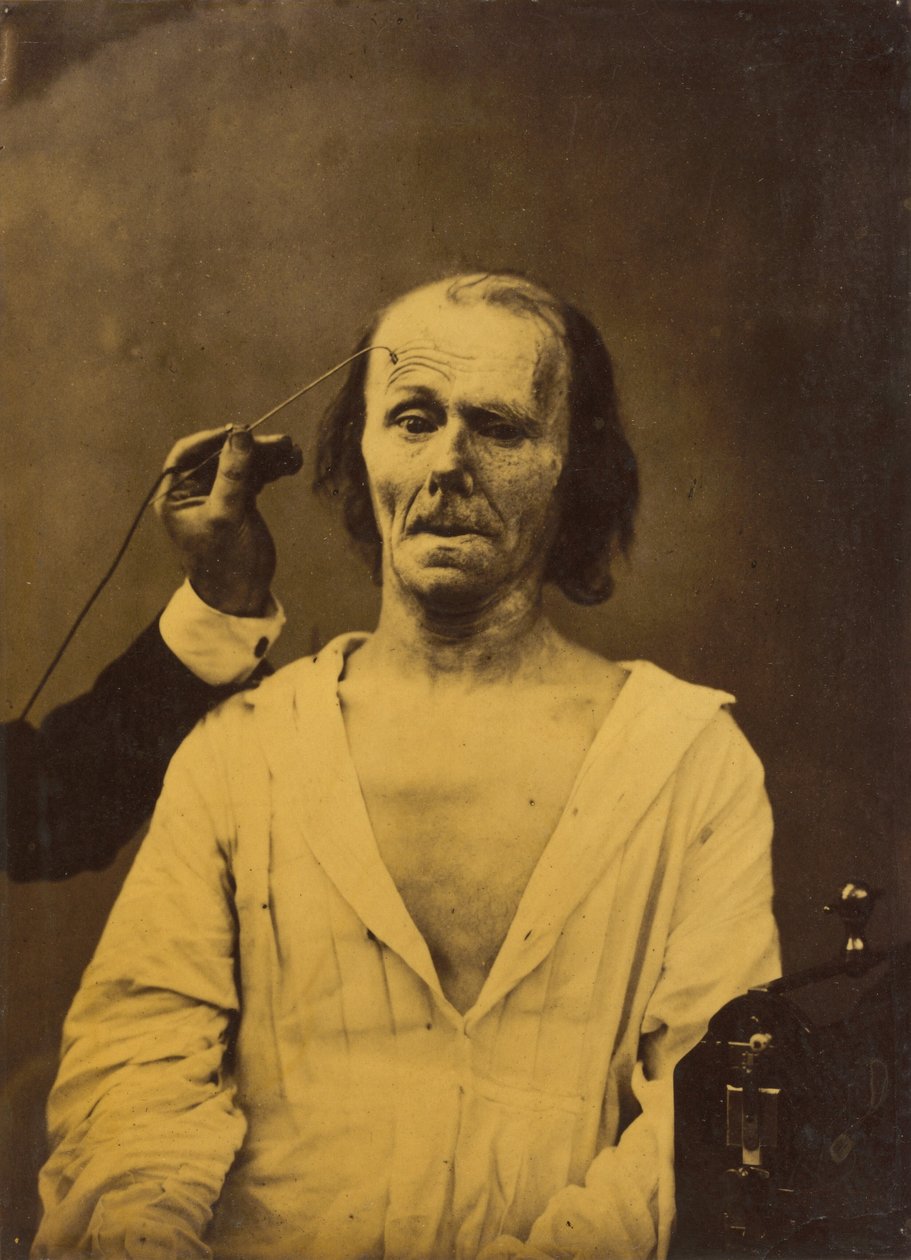 Un volto rilassato (sinistra); Attenzione profonda (destra) da Guillaume Benjamin Amant Duchenne