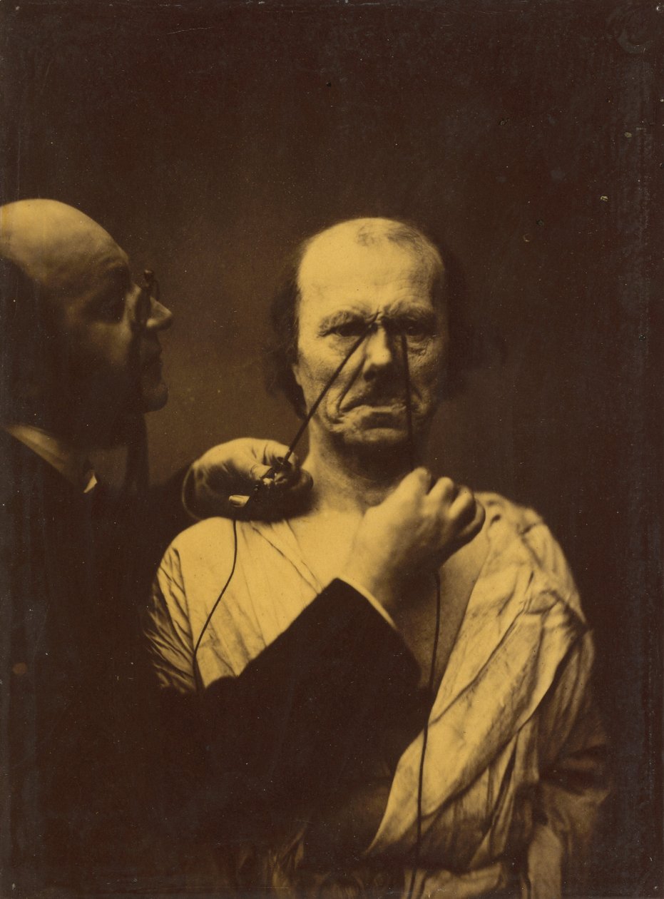 Aggressione, malvagità da Guillaume Benjamin Amant Duchenne