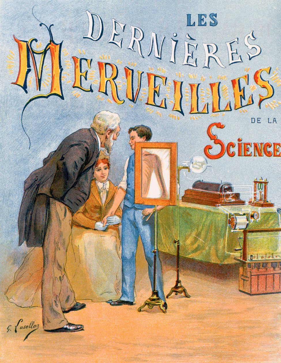 Esame del braccio di un bambino tramite radiografia da Gustave Francois Lasellaz