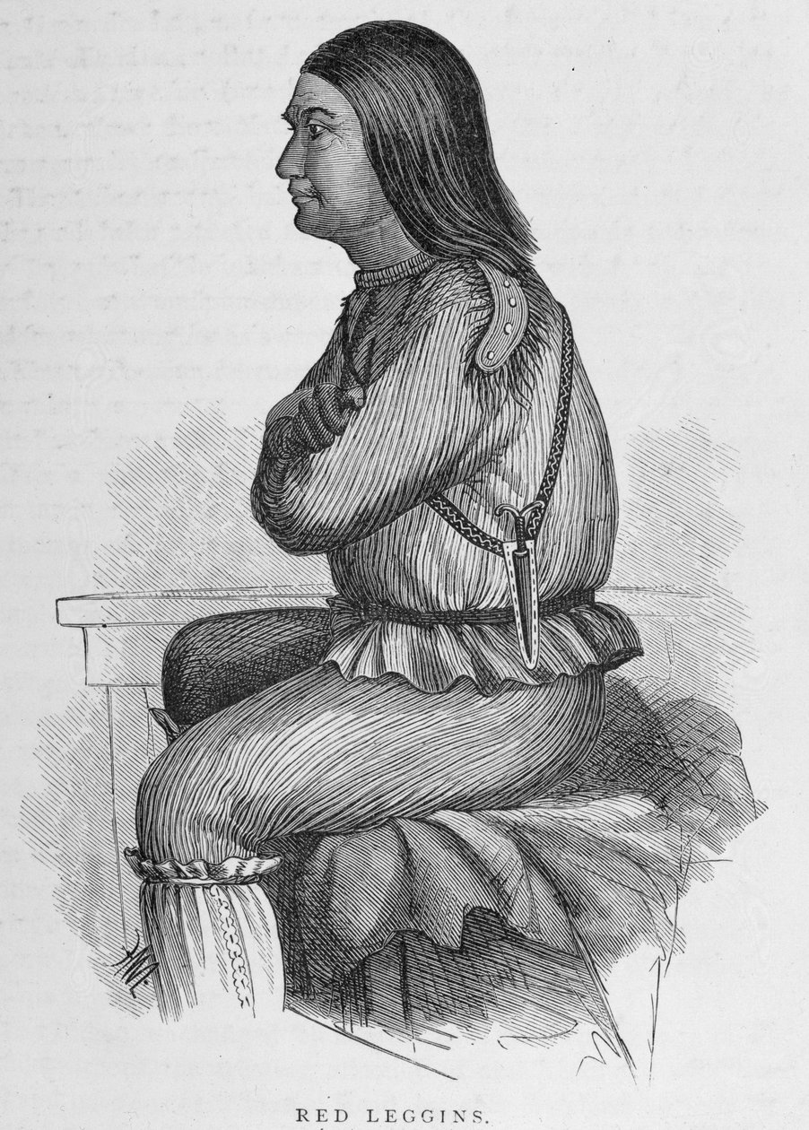 Red Leggins, Capo a Fort Yukon, da 