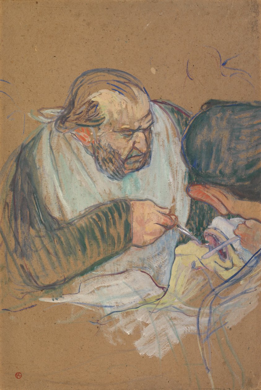 Il dottor Péan opera da Henri de Toulouse-Lautrec