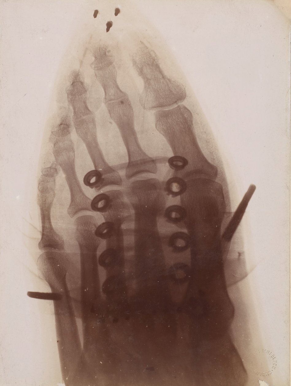 Il piede attraverso la scarpa da Henri van Heurck