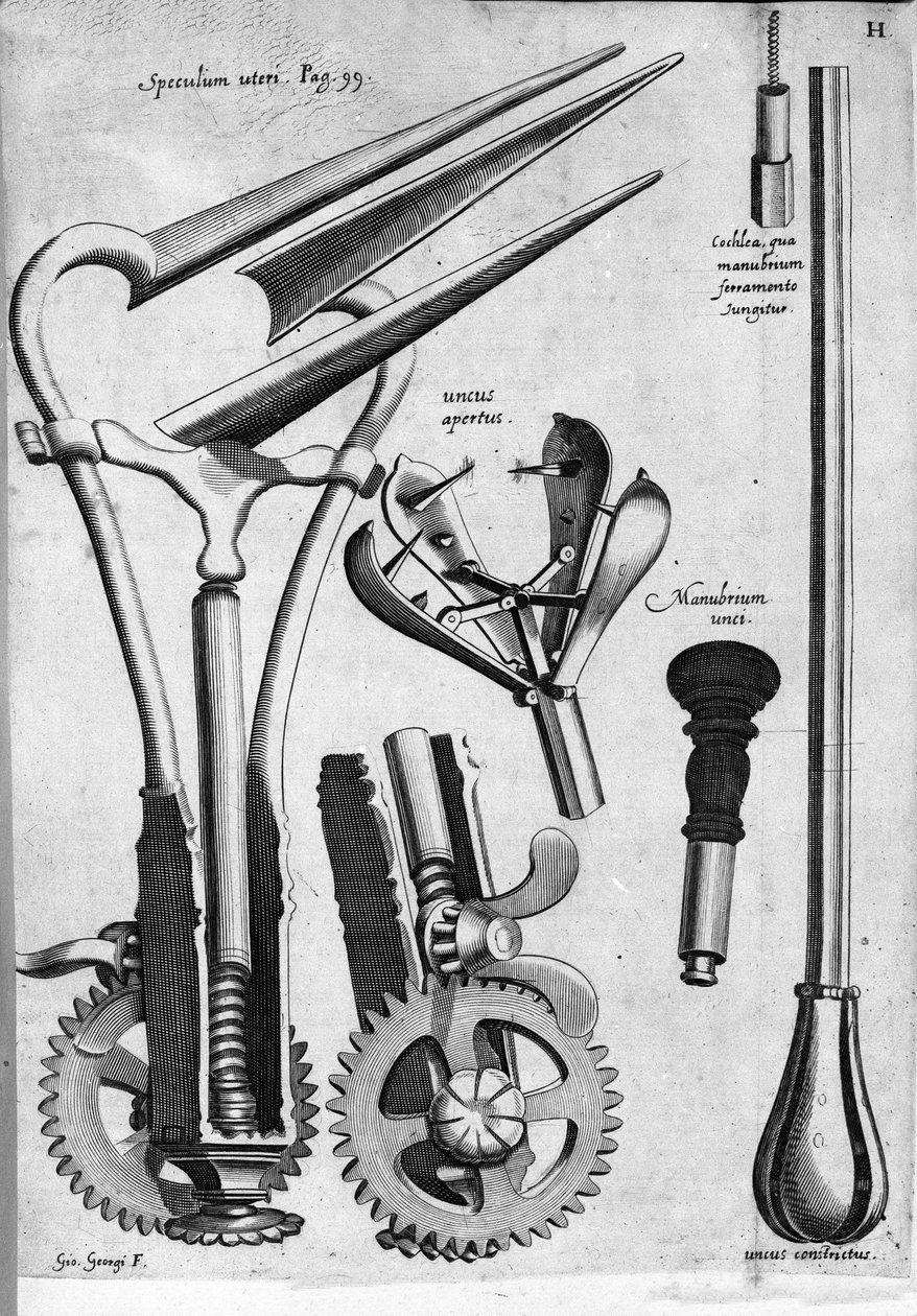 Ginecologia: Tavola che rappresenta uno speculum. Incisione di Girolamo Fabricii in "Opera Surgica", Padova da Hieronymus Fabricius ab Aquapendente