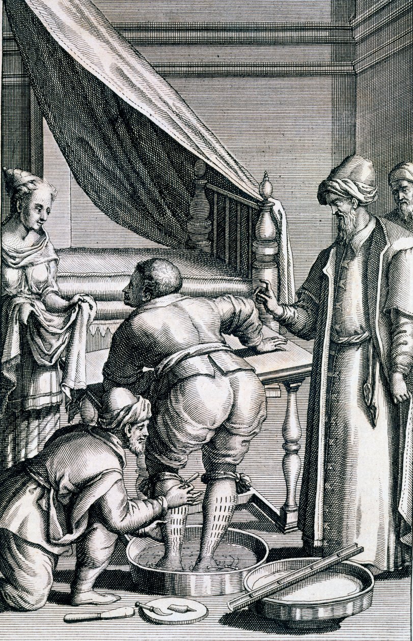 Salasso nelle gambe, da Medicina Aegyptiorum di Prospero Alpini, pubblicato 1745 da Italian School