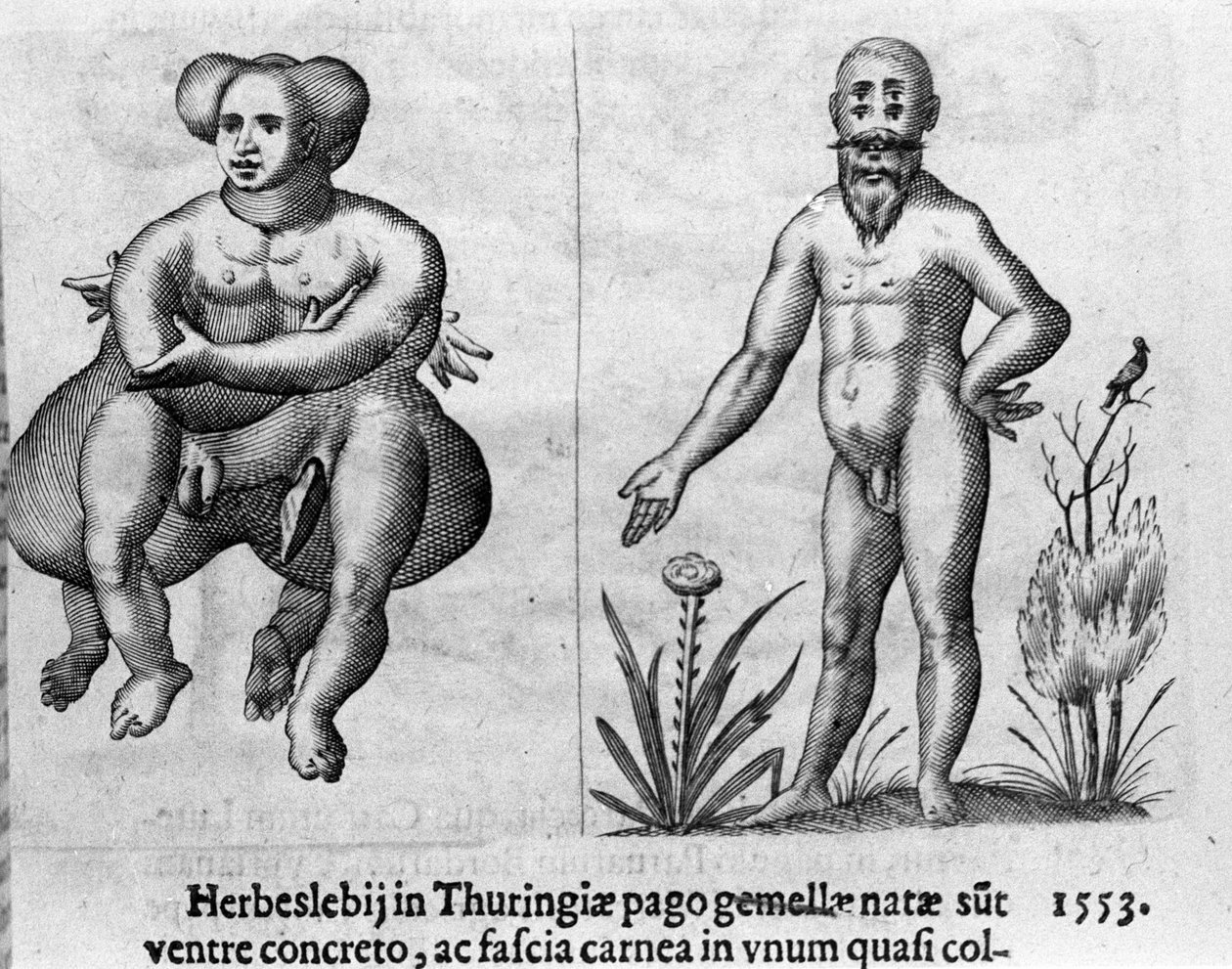 Diversi tipi di mostri umani. Incisione da “De monstrorum natura, causis et differentiis” di Fortunio Liceti (1577-1656), scienziato italiano. 1646 da Italian School