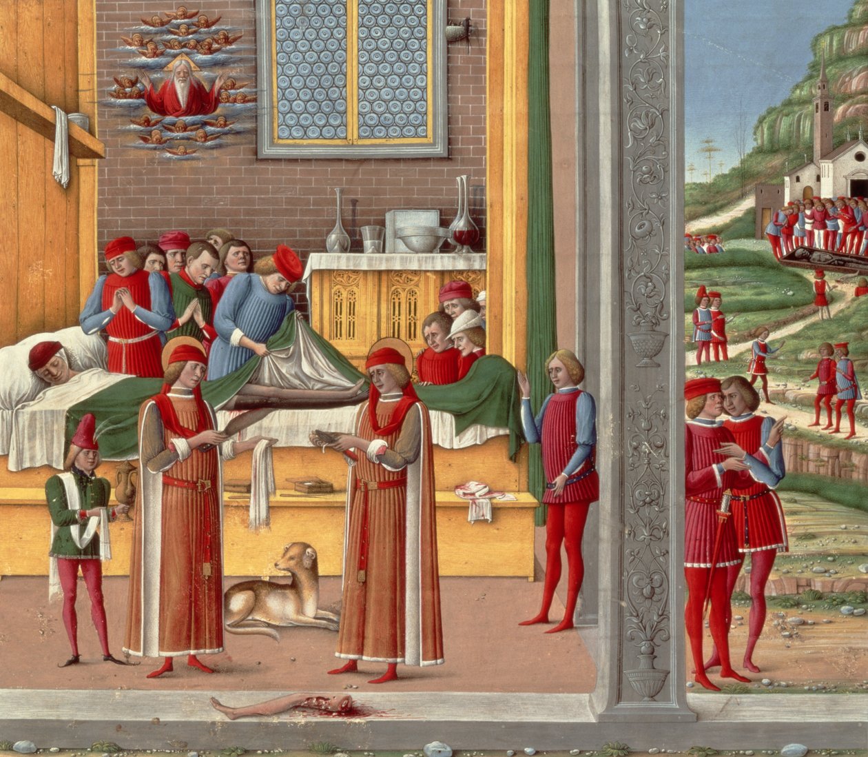 Scena di amputazione medievale da Italian School