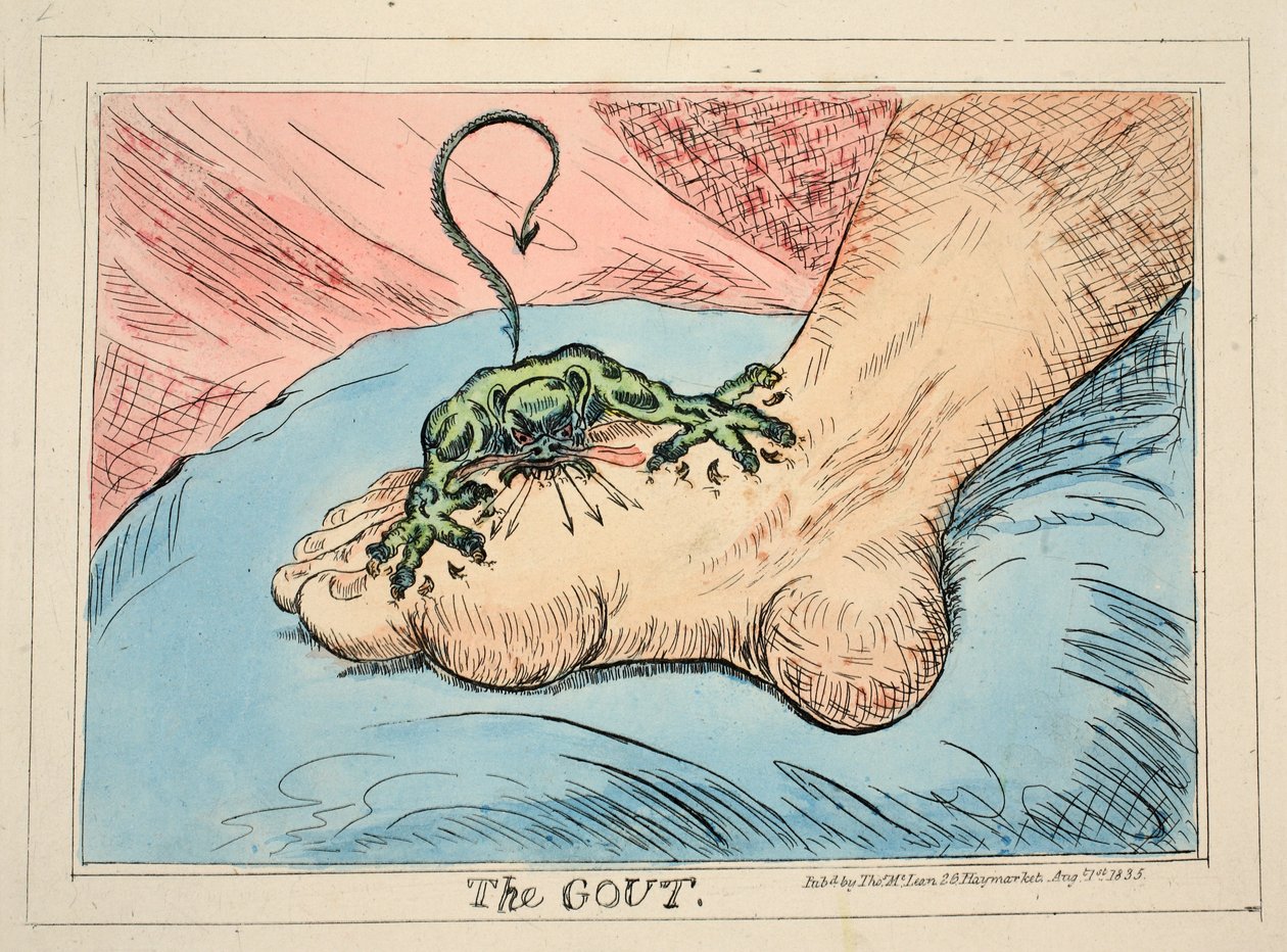 La Gotta, pub. 1835 da James Gillray