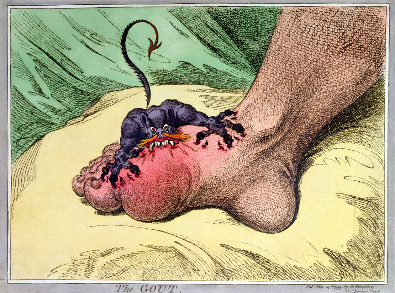 La gotta, pubblicato da Hannah Humphrey nel 1799 da James Gillray