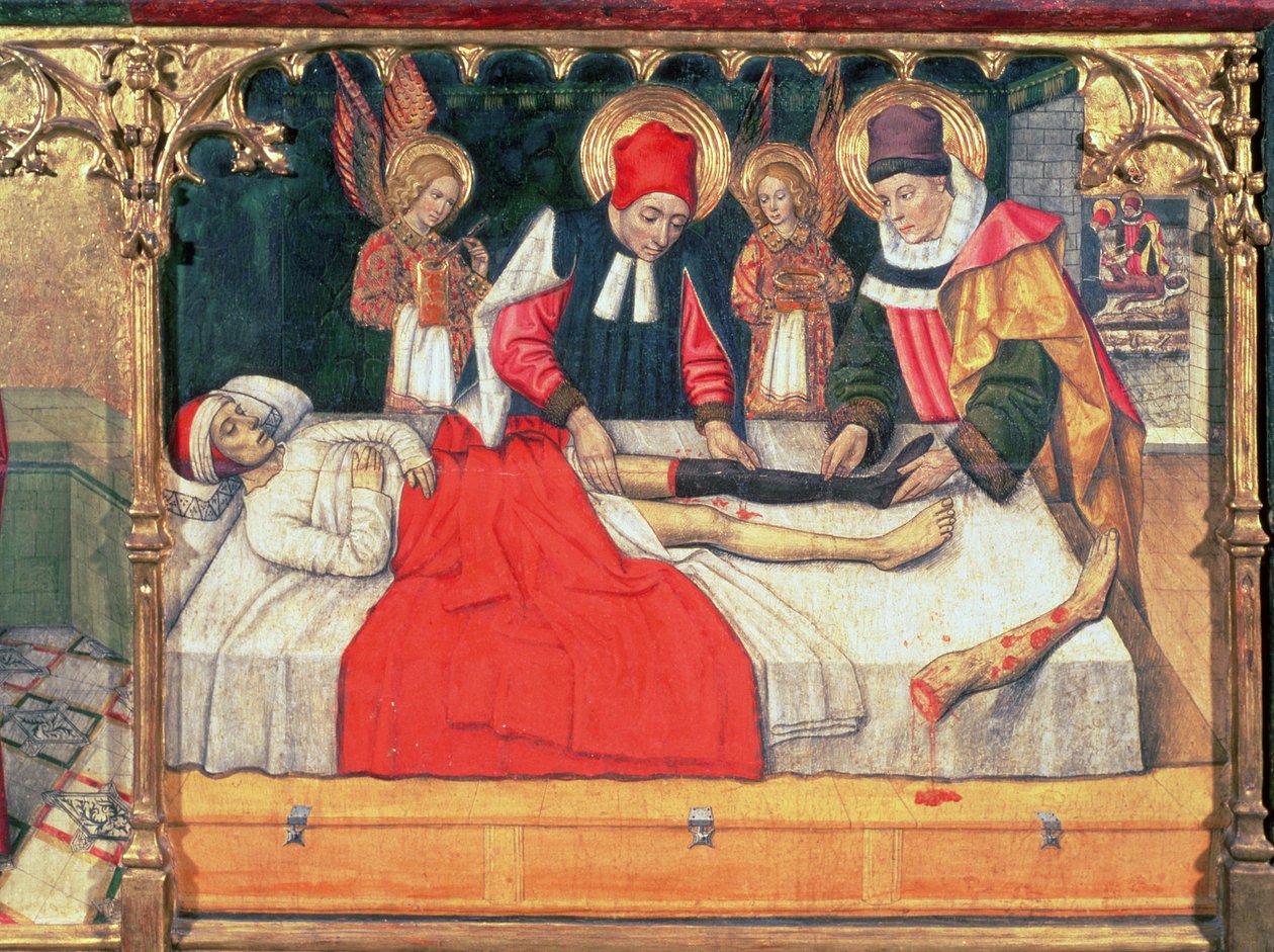 SS. Cosma e Damiano innestano la gamba di un uomo etiope sul moncone del diacono Giustiniano da Jaume Huguet