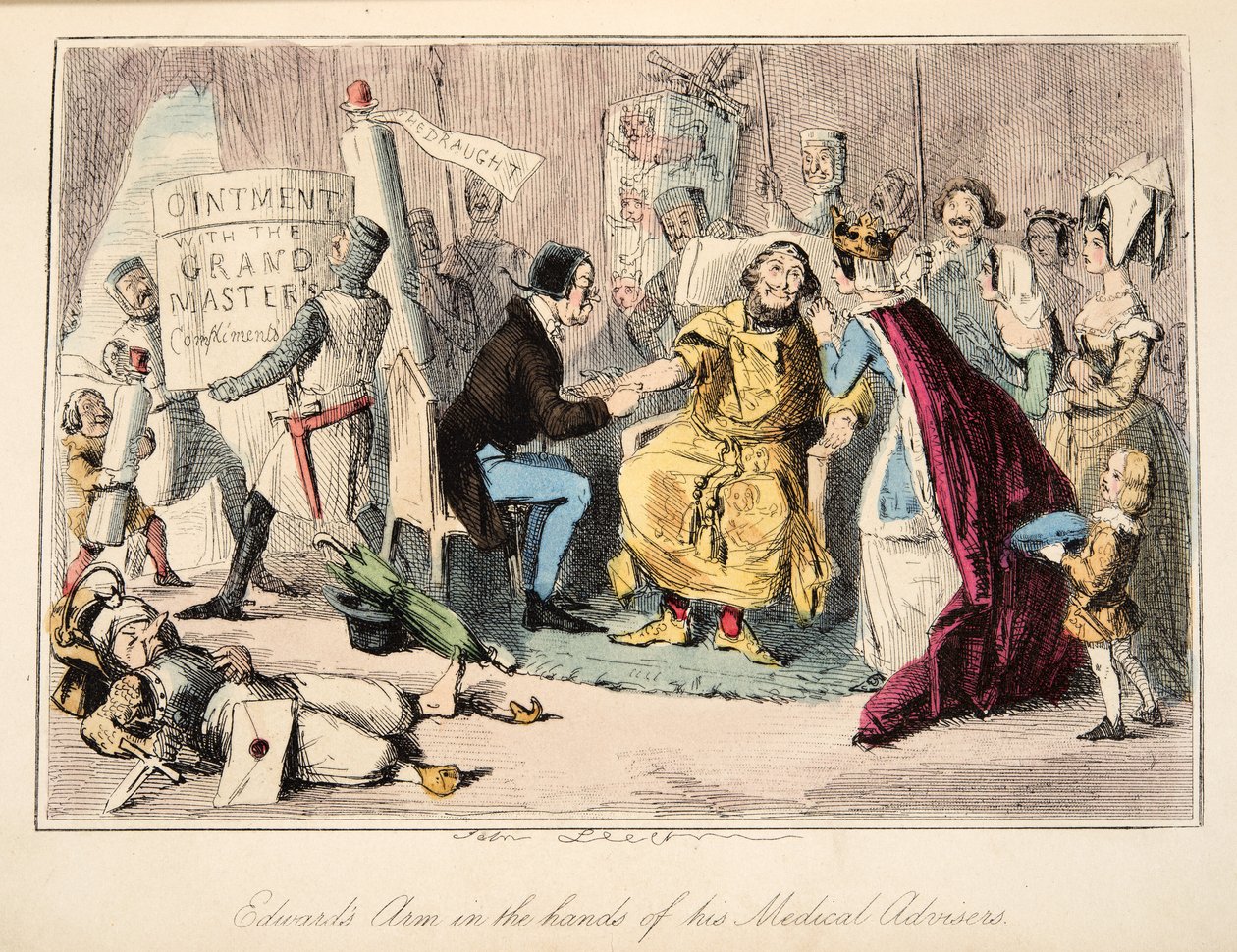 Il braccio di Edoardo nelle mani dei suoi consiglieri medici, da The Comic History of England, pub. 1864 da John Leech