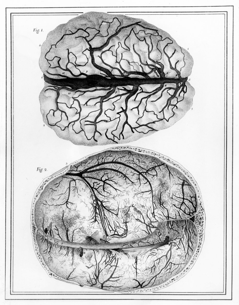 Il Cervello, 1825 da Jules Germain Cloquet